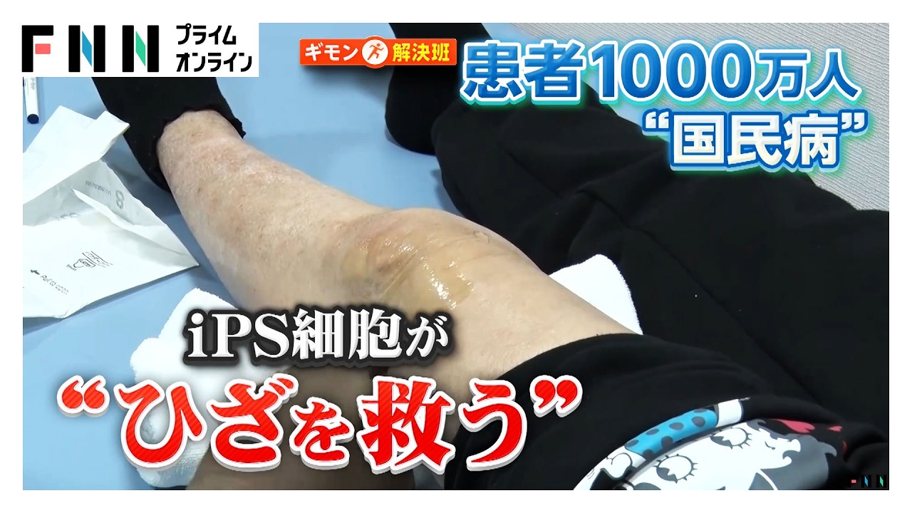 iPS細胞が1000万人の“ひざを救う”？“世界初”人工軟骨の新技術…安全面・生産コストが課題（2026年03月13日） img